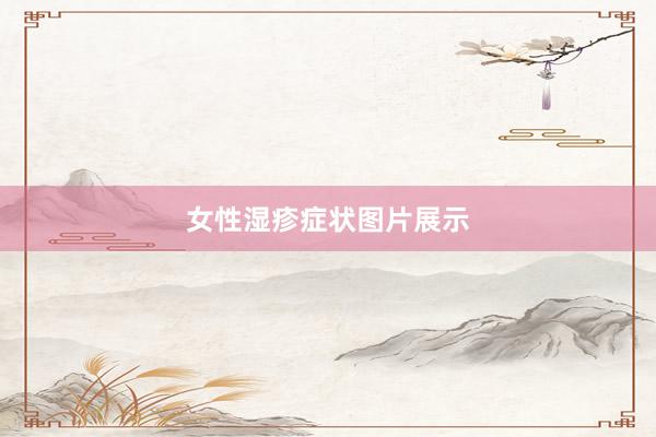 女性湿疹症状图片展示